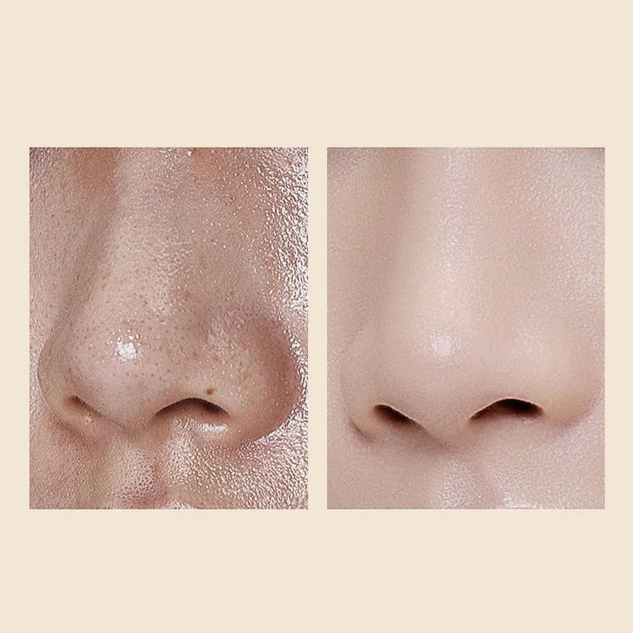 אמפולת פילינג אורז