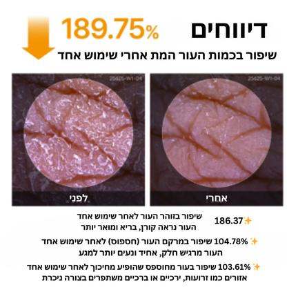 ספריי כורכום