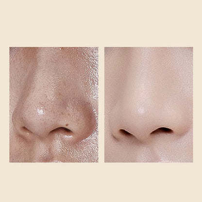 אמפולת פילינג אורז